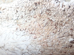 Placopsis centrifuga