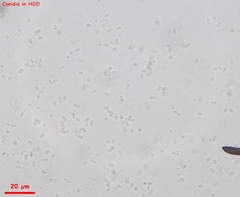 Trichoderma flavipes