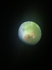 Eriococcus abditus