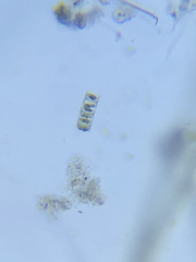 Hyalotheca