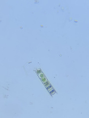 Hyalotheca