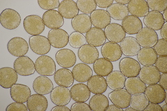 Puccinia chaerophylli
