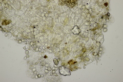 Entorrhiza aschersoniana