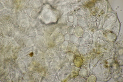 Entorrhiza aschersoniana