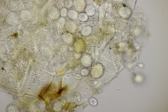 Entorrhiza aschersoniana