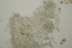 Entorrhiza aschersoniana