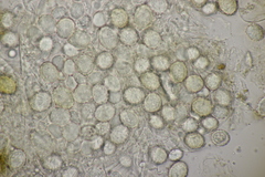 Entorrhiza aschersoniana
