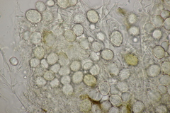 Entorrhiza aschersoniana
