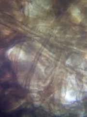 Acephala