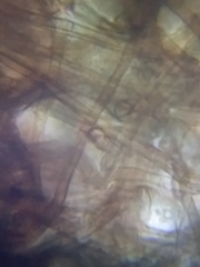 Acephala