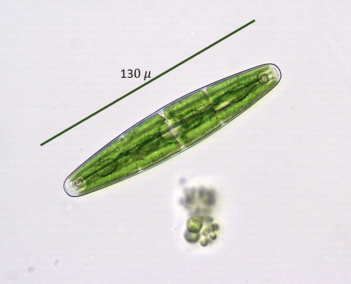 Variety Closterium closterioides intermedium · iNaturalist