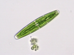 Closterium closteroides intermedium