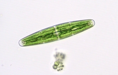 Closterium closteroides intermedium