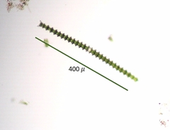 Triploceras gracile