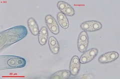 Peziza griseorosea
