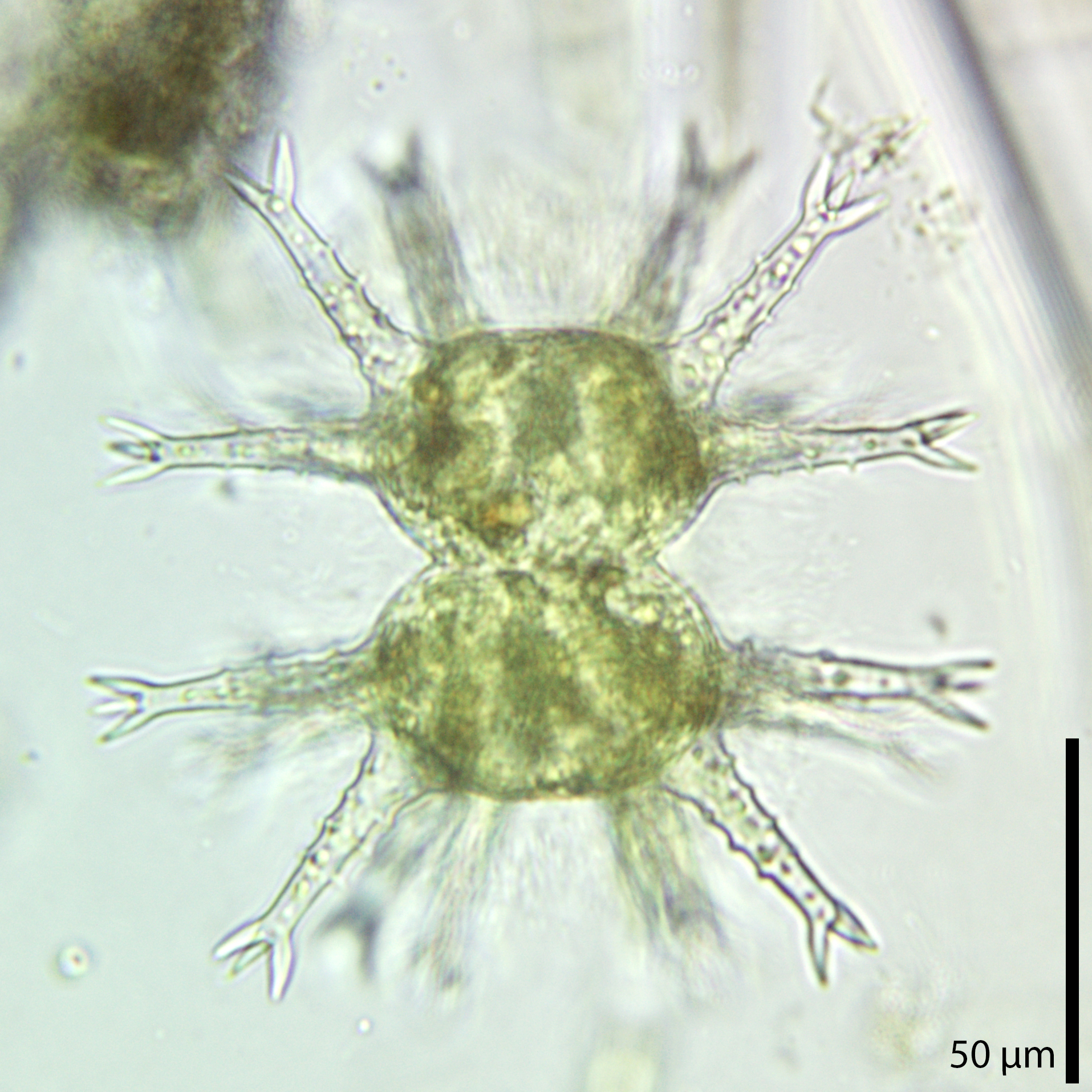 Staurastrum arctiscon
