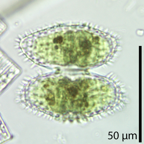 Staurastrum brebissonii