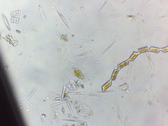Mallomonas caudata