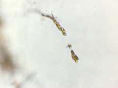 Encyonema
