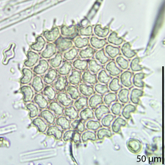 Pseudopediastrum boryanum longicorne