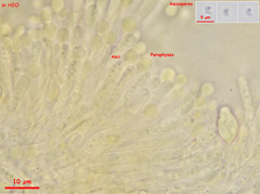 Orbilia xanthostigma