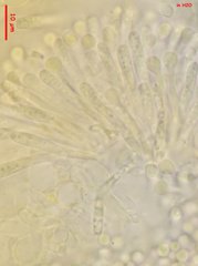 Orbilia xanthostigma