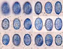 Scutellinia vitreola