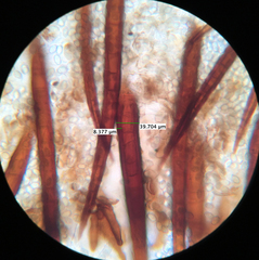 Scutellinia vitreola