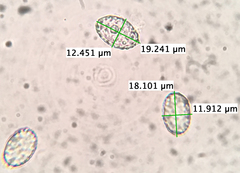 Scutellinia vitreola