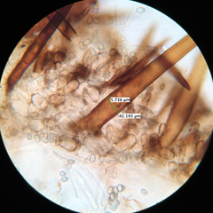 Scutellinia vitreola