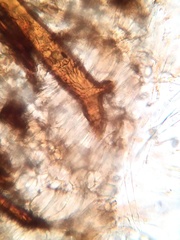 Scutellinia vitreola