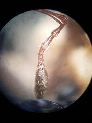 Brachyphyes thoracicus