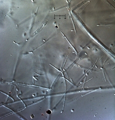 Engyodontium aranearum