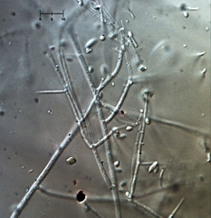 Engyodontium aranearum