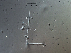 Engyodontium aranearum