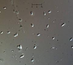 Engyodontium aranearum