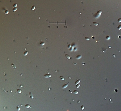 Engyodontium aranearum