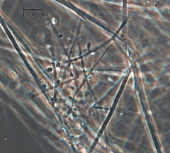 Engyodontium aranearum