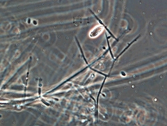 Engyodontium aranearum