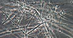 Engyodontium aranearum