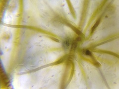 Gloeotrichia echinulata