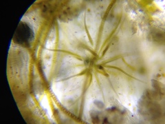 Gloeotrichia echinulata