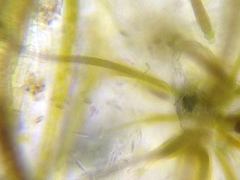 Gloeotrichia echinulata