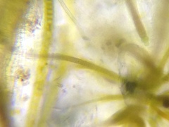 Gloeotrichia echinulata