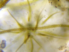 Gloeotrichia echinulata