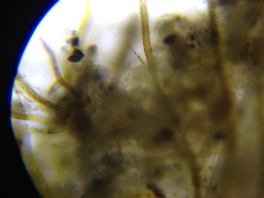 Gloeotrichia echinulata