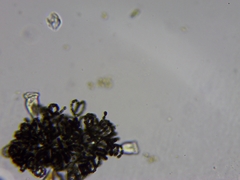 Dolichospermum lemmermannii