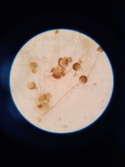 Rhizopus stolonifer