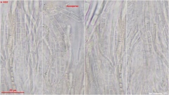 Strossmayeria basitricha