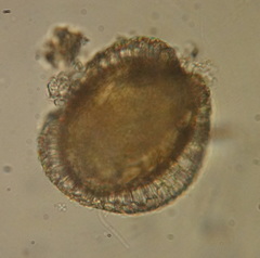 Rotifera
